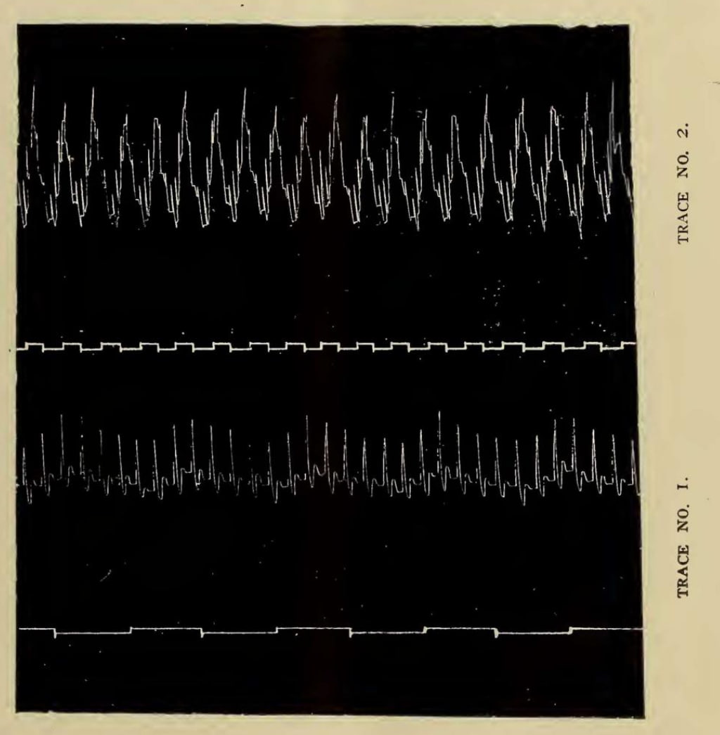Physiological tracings from Robinovitch's 1906 electric sleep experiments showing cardiac and respiratory patterns
